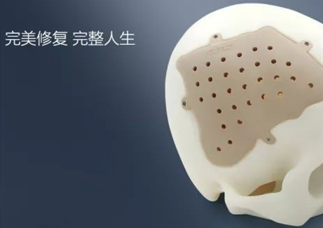 精準定制，完美修復——從“頭”開始