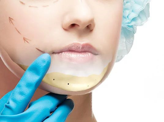 醫用材料“網紅”，也進軍整形美容界了！